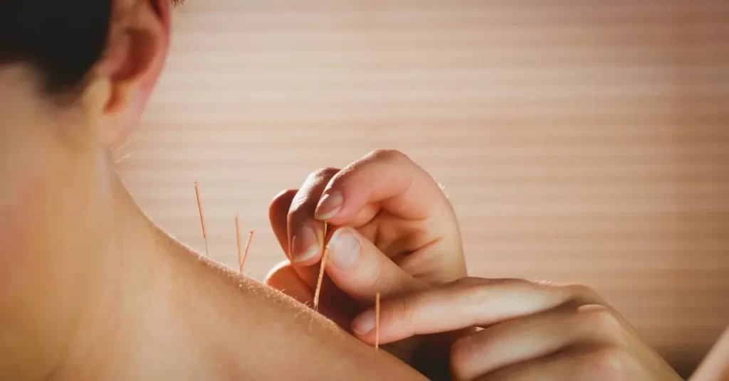 Dry-needling-wordt-vaak-gebruikt-voor-de-behandeling-van-aandoeningen-zoals-rugpijn-nekpijn-hoofdpijn-gewrichtspijn-en-spierspanningen.